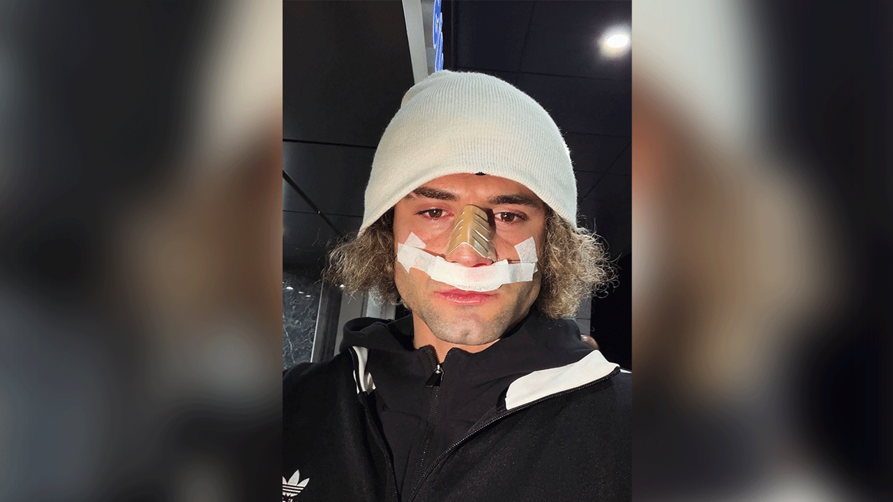 Elazığspor’da Fuat Bavuk’un burnu kırıldı